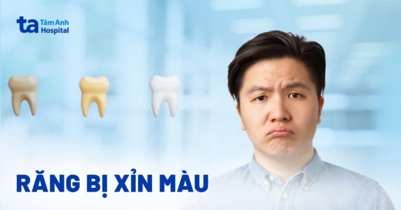 Nguyên nhân răng ố vàng xỉn màu, các yếu tố gây đổi màu răng